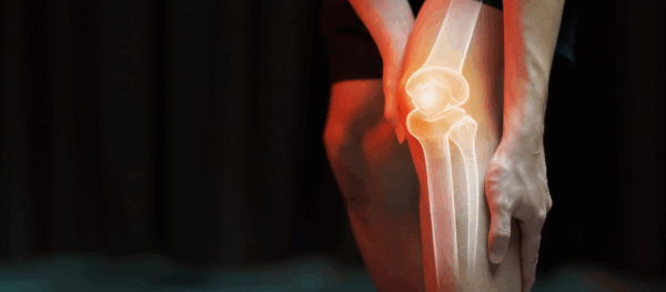 Natural Relief for Arthritis